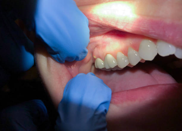 Best After-Hours Dental Trauma Care in Galliano, LA